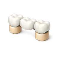 Dental Bridge isometric 3D icon for dental care, dentistry, and oral health visuals