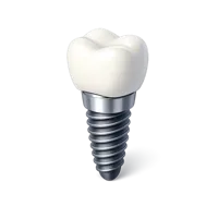 Dental implant isometric 3D icon for oral health, dentistry, and clinic design