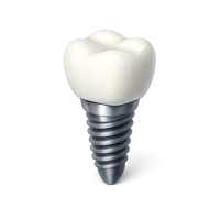 Dental Implant 3D icon