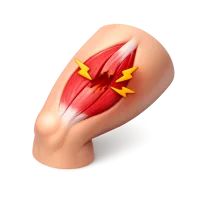 Muscle Strain 3D icon